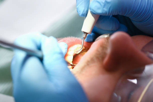 Best Emergency Dentist for Knocked-Out Tooth in Henning, TN