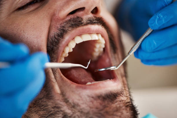 Best Pediatric Emergency Dentist in Henning, TN